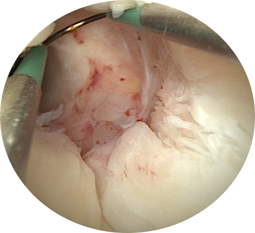 resecare_5