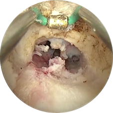 resecare_6