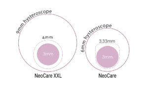 Schema of diameter differences between NeoCare and NeoCare XXL